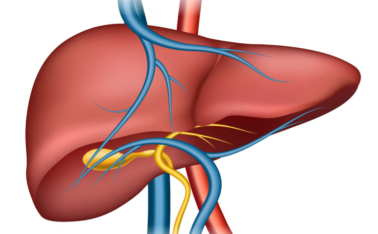  Stages Of Alcoholic Liver Disease And How it’s Treated