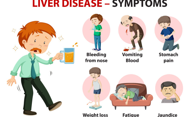  Liver Disease – Symptoms, Causes, Treatment and Diet