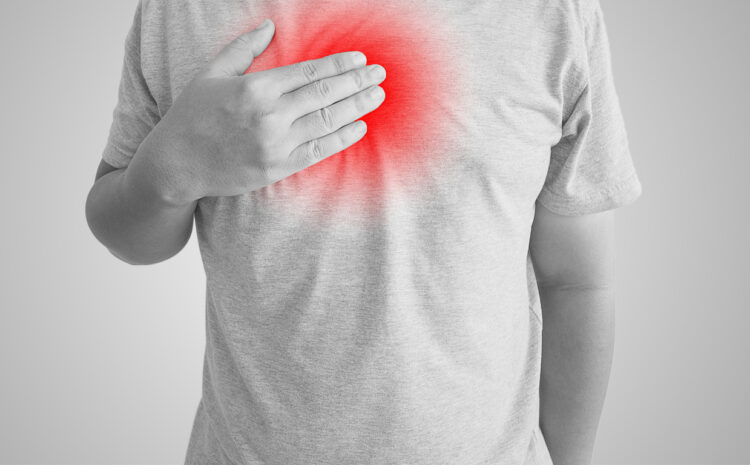  Heartburn and Acid Reflux: What You Need to Know