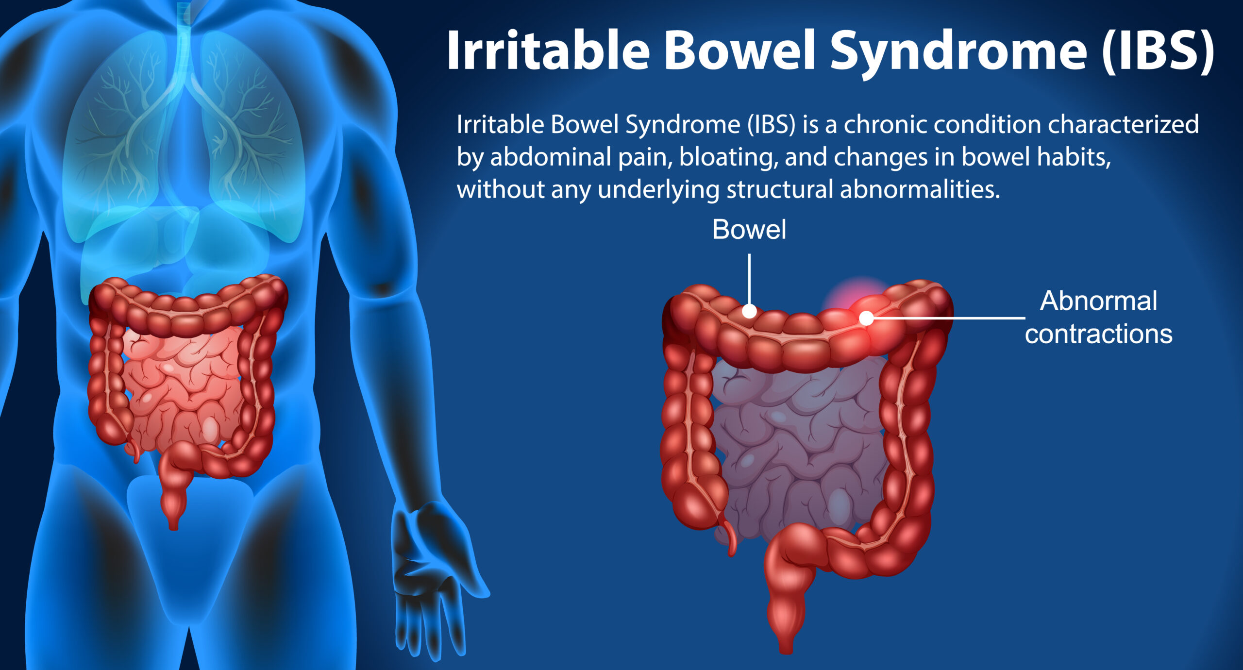 Irritable Bowel Syndrome (IBS): Causes, Symptoms, and Management