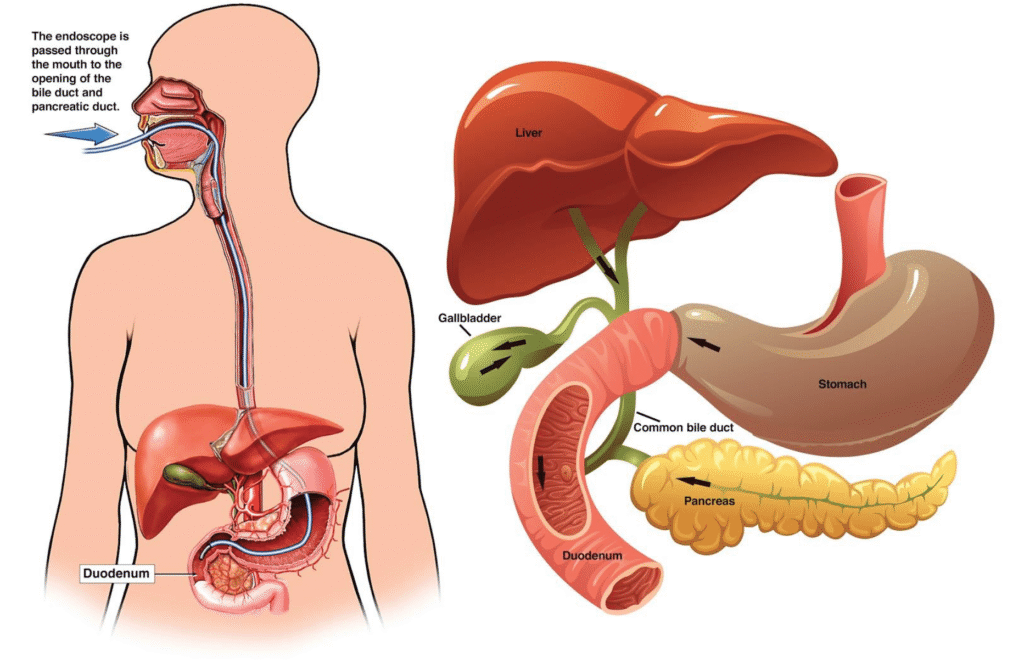 ERCP Procedure Explained: Purpose, Preparation, and Recovery