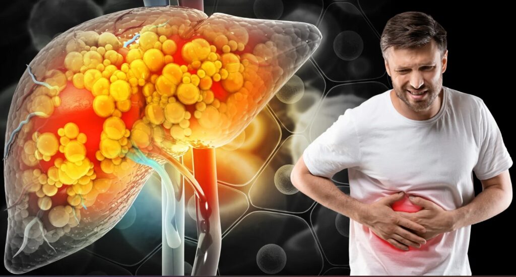 Fatty Liver Treatment: When to Visit the Best Gastroenterologist in Faridabad